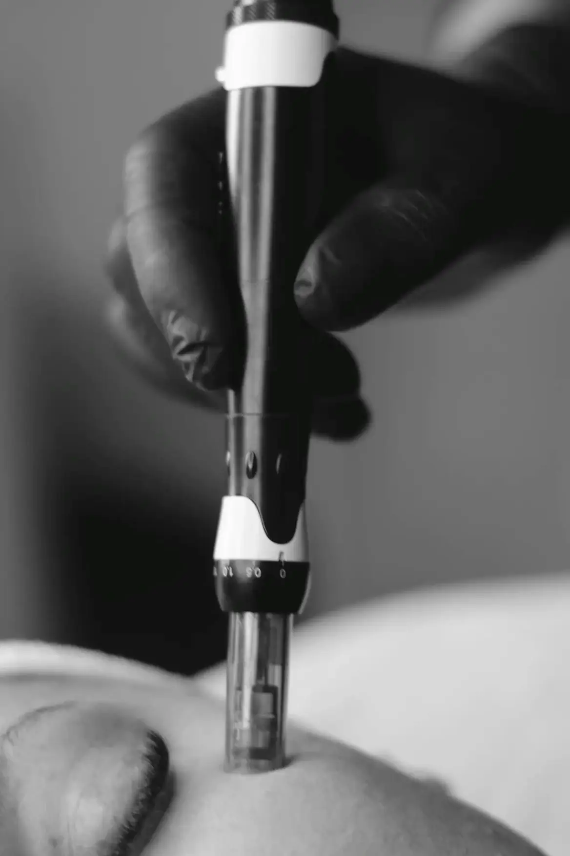 Microneedling Facial